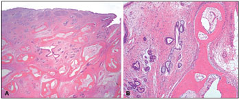 Histological sections of the COREAH specimen